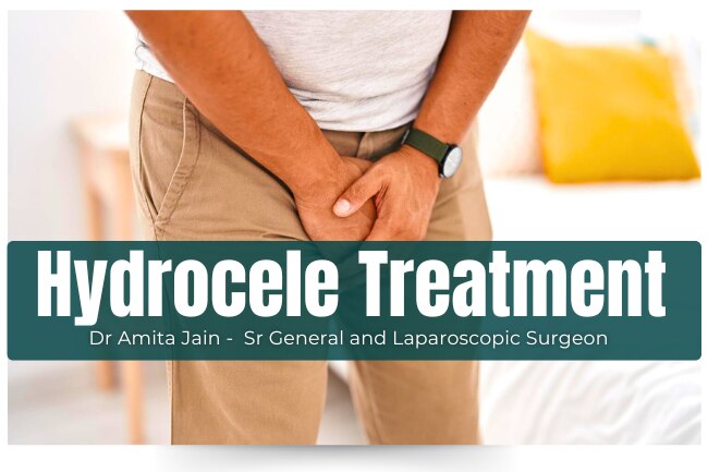 best Hydrocele treatment and Surgery by Dr Amita Jain Hydrocele treatment and Surgery